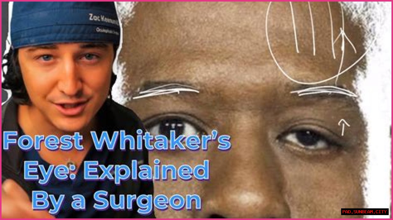 Unveiling Forest Whitaker's Eye Condition: Discoveries And Insights